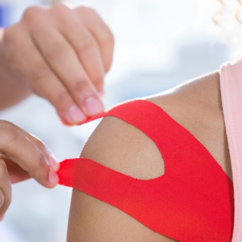 Physiotherapist sticking tape on female patient